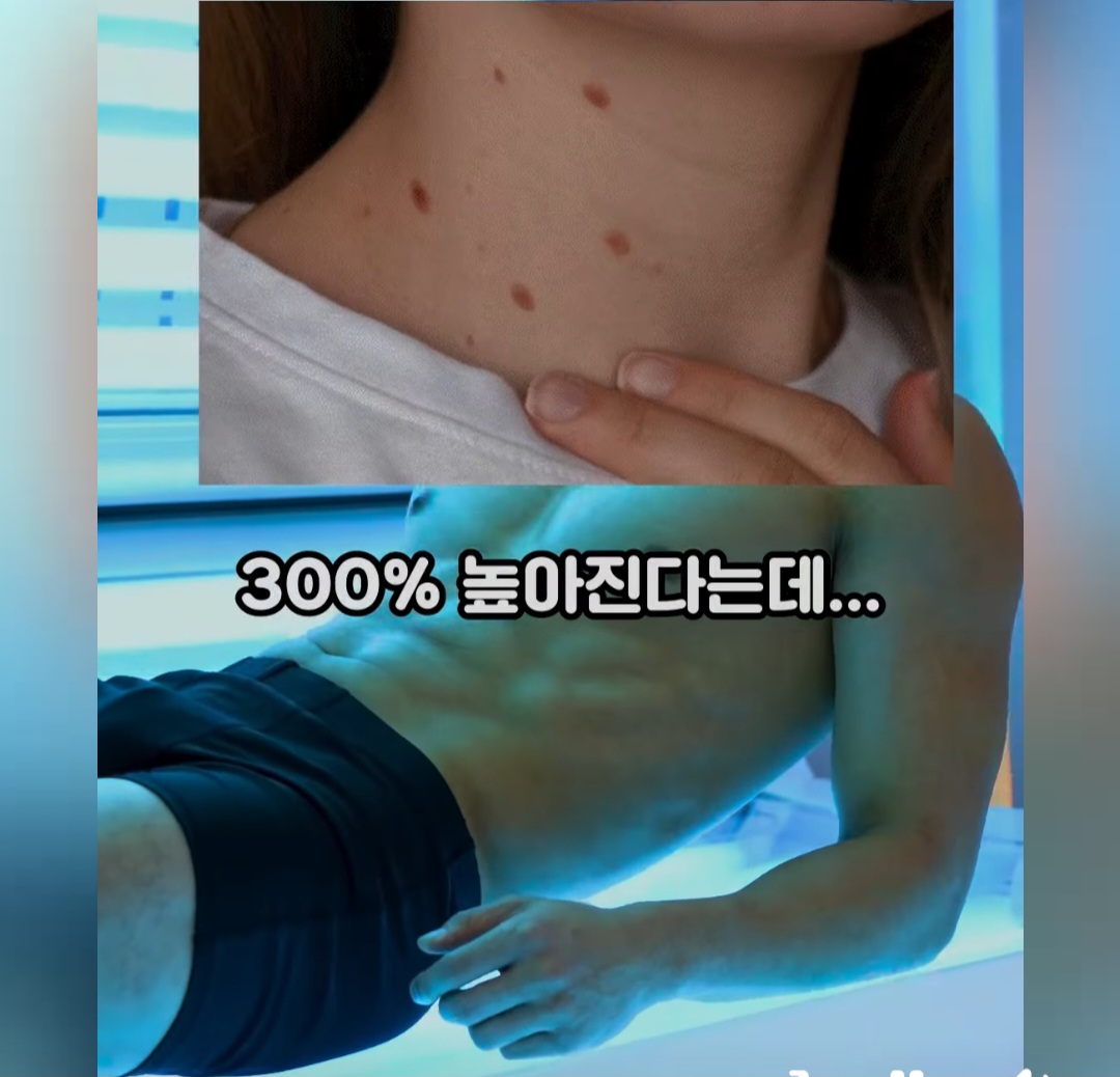 태나무숲 게시글 첨부 이미지 2
