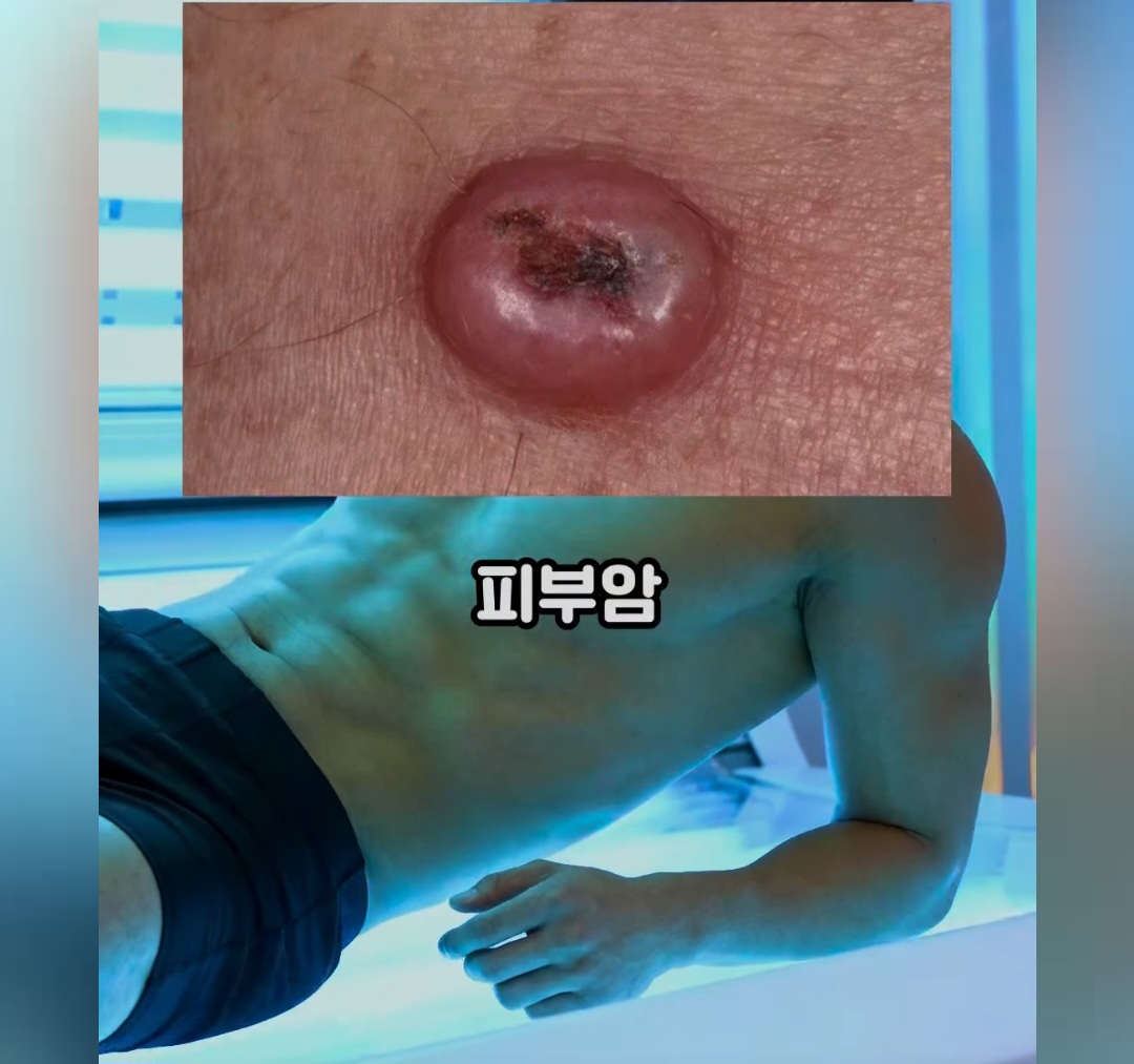태나무숲 게시글 첨부 이미지 1